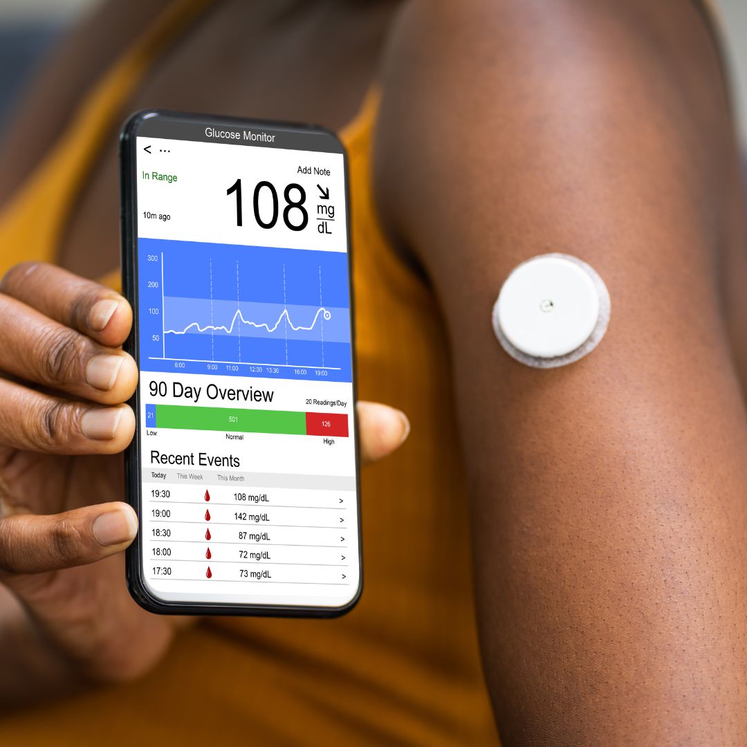 Blood sugar monitor affixed on an arm with the hand on the other arm showing the screen of their iPhone with tracking information on display